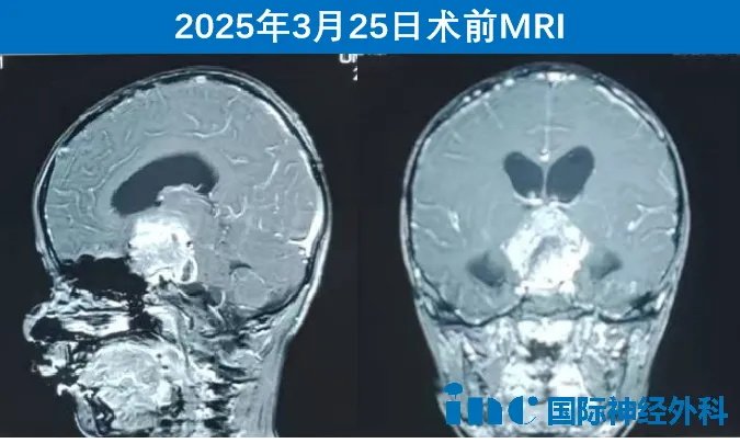 案例